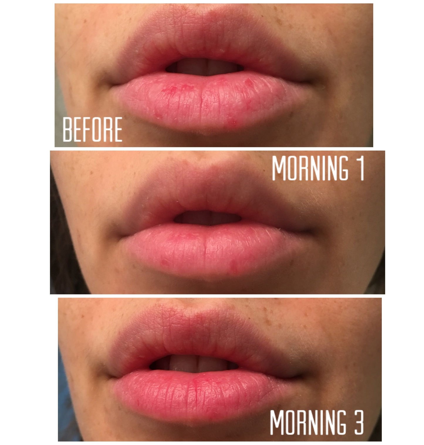 Overnight Lip Mask