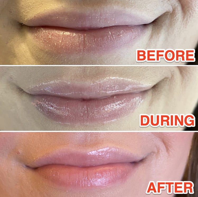 Overnight Lip Mask